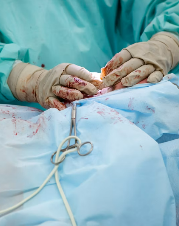 Surgical Wound Care