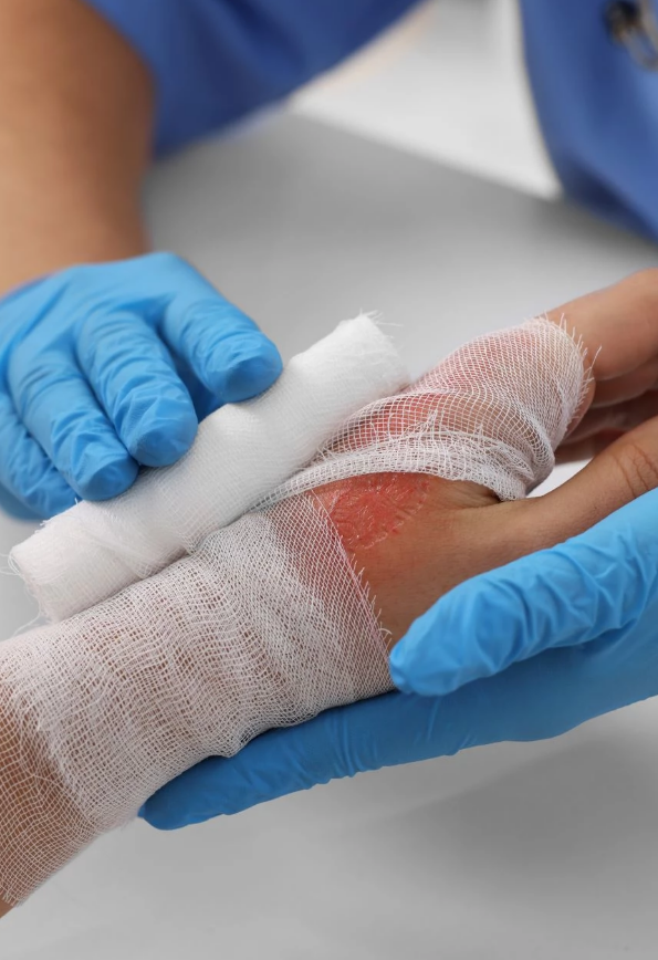 Burn Wound Management