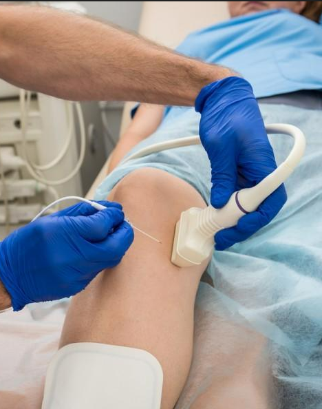 Venous Leg Ulcer Treatment